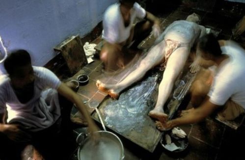 女性分泌物黄粘稠成胶的相关介绍